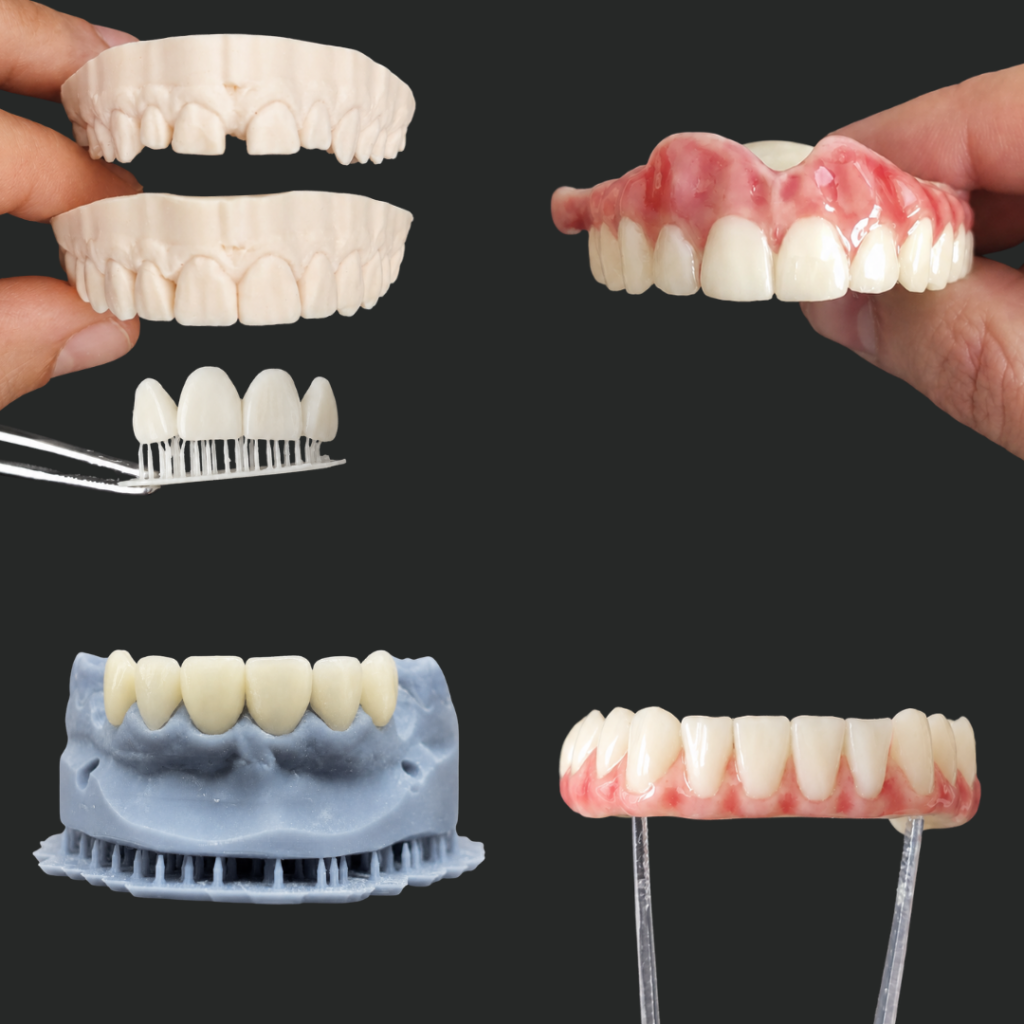 Restauraciones dentales digitales fabricadas: provisionales de carga inmediata, prótesis completas, carillas, coronas y puentes impresos/fresados con precisión milimétrica