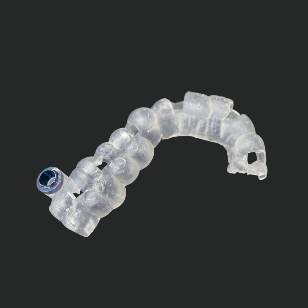 Guía quirúrgica de microtornillos de ortodoncia impresa en 3D para posicionamiento preciso de anclaje esquelético con control de posición inicial y final de raíces